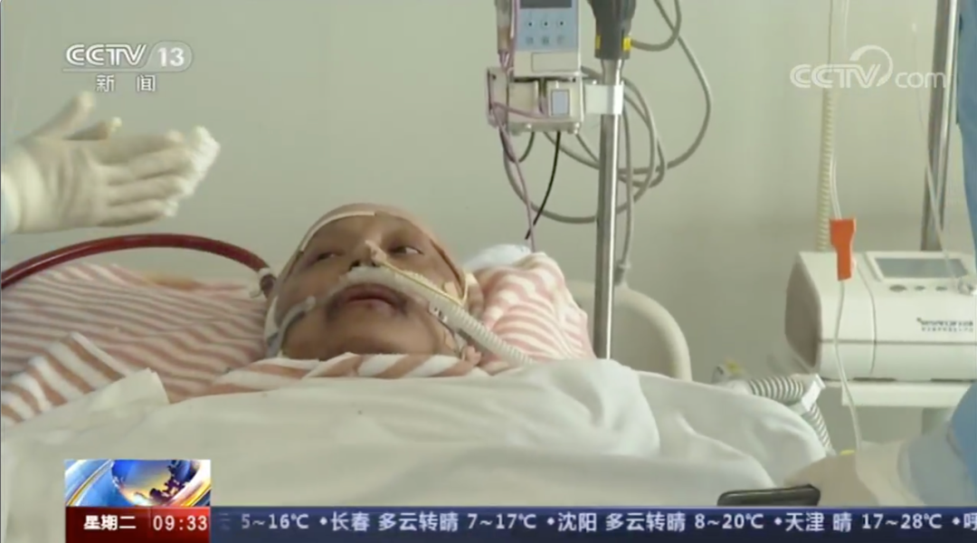 “黑脸”医生白回来了!再见救命恩人,他最想