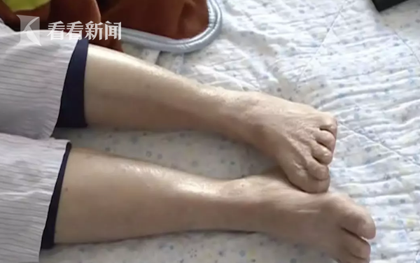 老人住院手术惹祸端 医生：没看清治错了位置