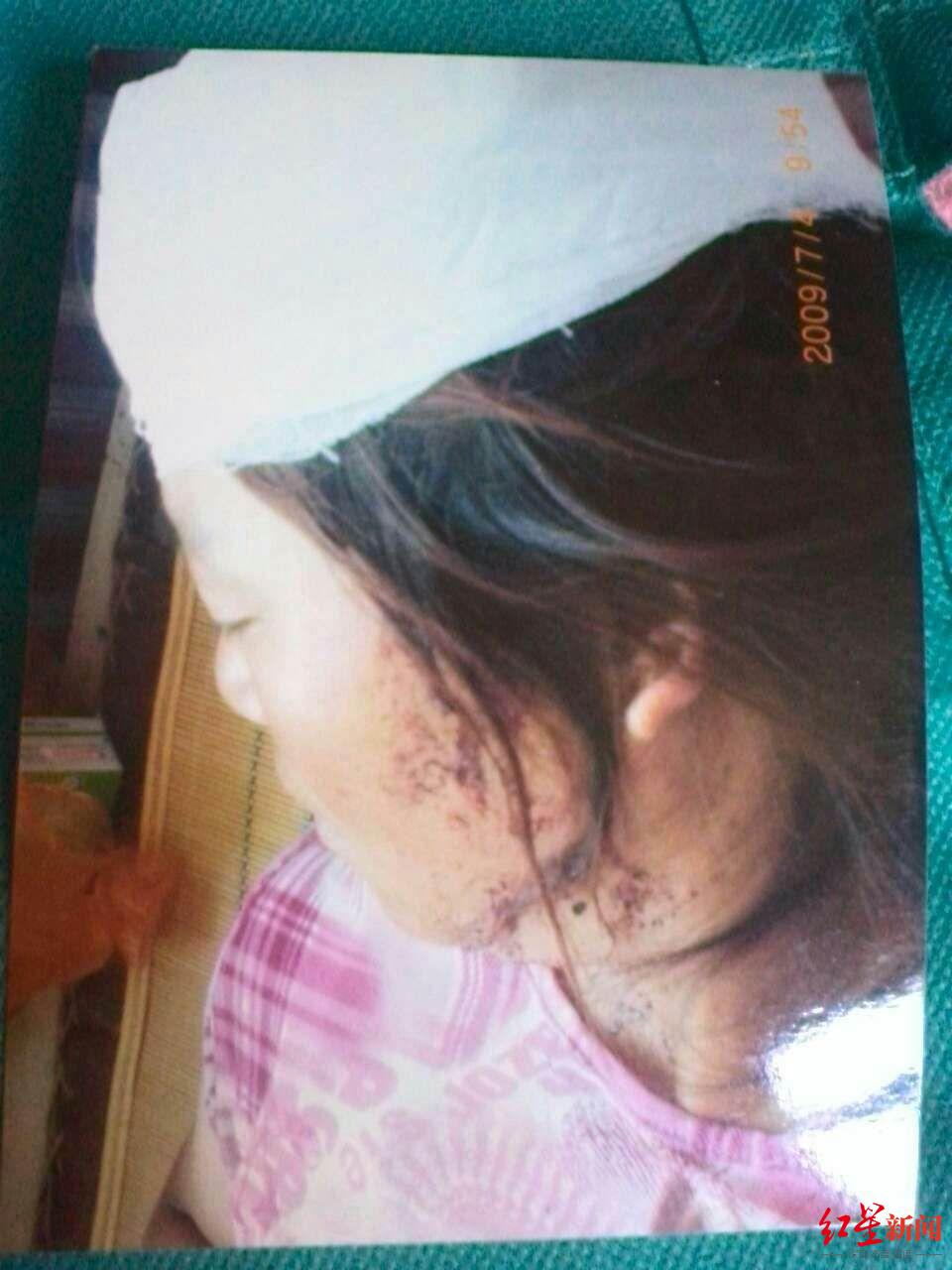 “反杀”夤夜闯宅行凶者后的4126天