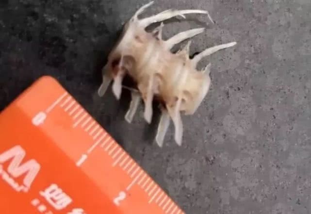 男子不小心鱼刺卡喉,医生竟让他吃手套!结果……