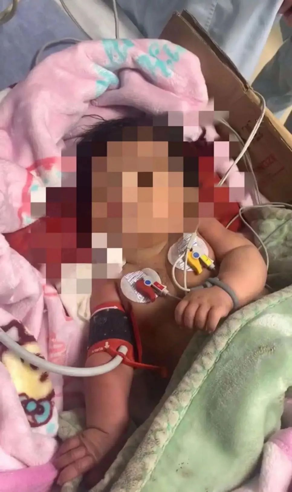 三问“石家庄女婴坠楼事件”