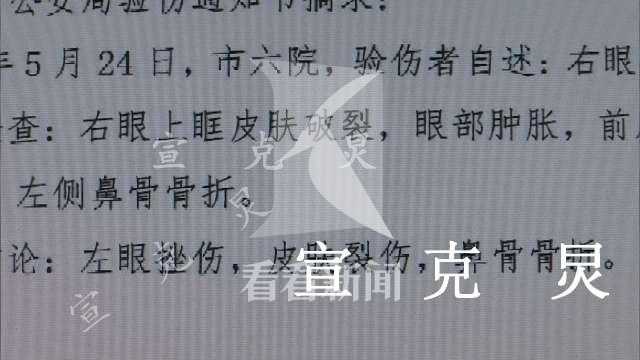 因开空调起争执 男子一拳打断同事鼻梁获刑一年