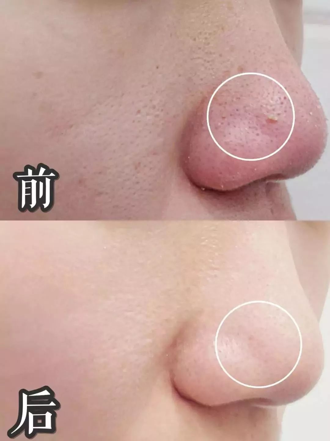 死要面子的包文婧,到底活得有多爽?