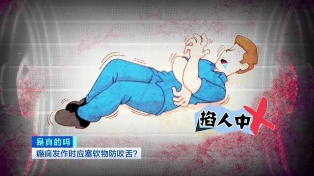 注意了!癫痫发作,在口中塞入软物防咬舌是错的!或致窒息