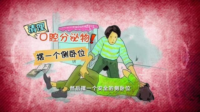 注意了!癫痫发作,在口中塞入软物防咬舌是错的!或致窒息