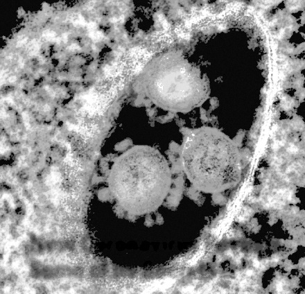 最近是不是有新型病毒 1742-intiarq1230101.jpg