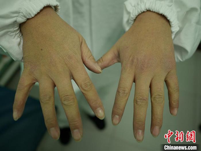 葛丽坤的双手像砂纸一样粗糙 苍雁 摄