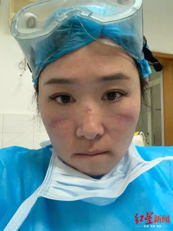 摘下防护的付馨余