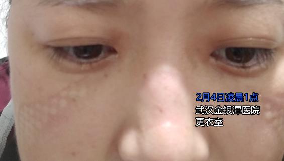 武汉一线护士自述：职责所在 没什么辛苦不辛苦