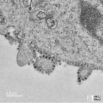 ▲香港大学电子显微镜图像显示了在细胞中生长的新型冠状病毒。