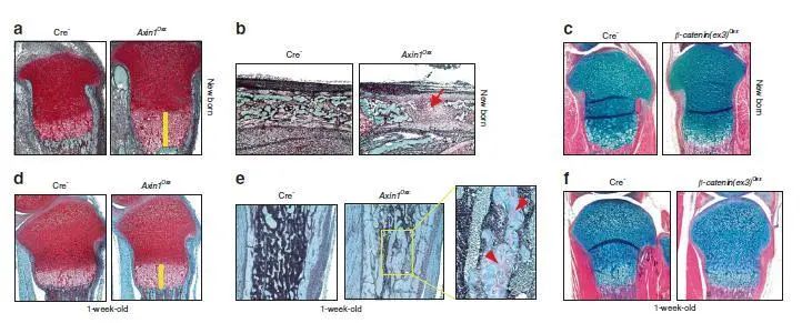 新闻|王拥军、陈棣联合团队在《Bone Research》发表骨发育调控机制的研究成果