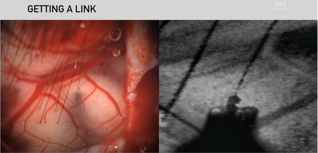 图片来源：Neuralink 发布会
