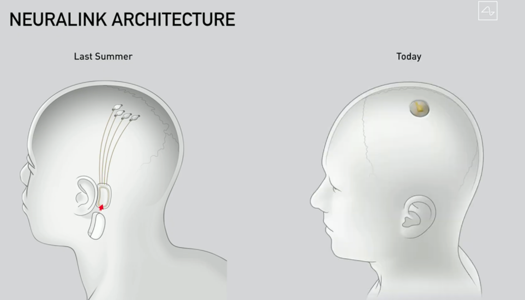 图片来源：Neuralink 发布会