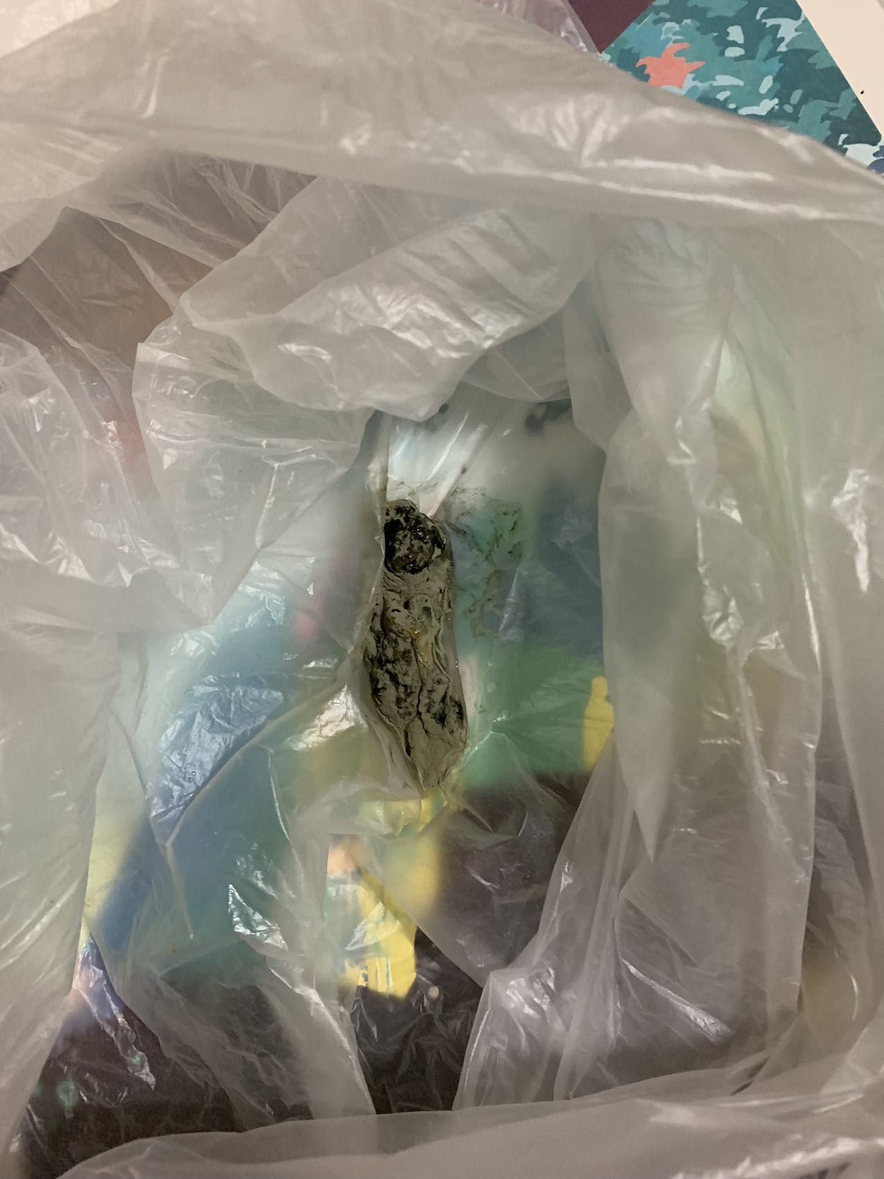 ▲程先生已将喝出的异物保存留证,目前该异物已经缩成一团。 新京报记者 李睿阳 摄