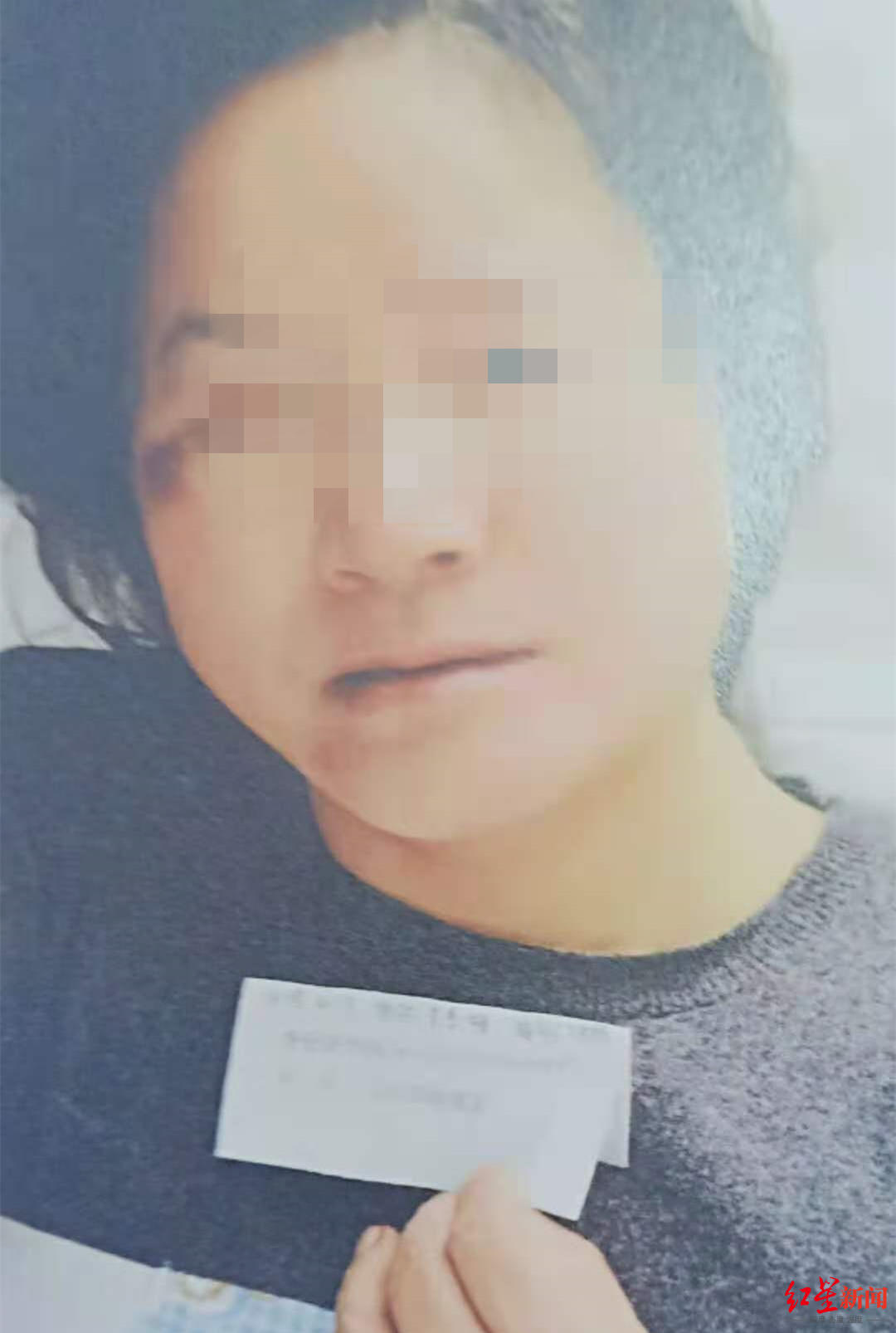 ▲遇袭后的赵丹