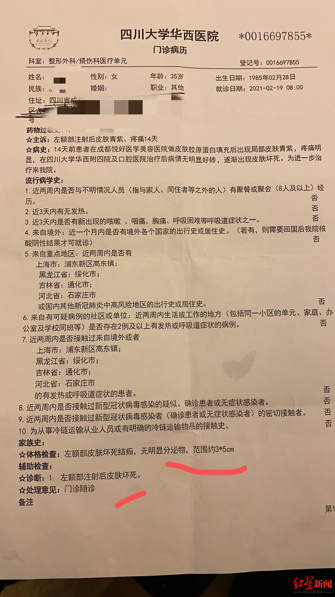 华西医院出具的门诊病历.