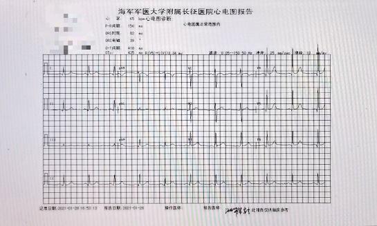 正常心电图水管检查—冠状动脉ct冠脉ct是利用ct快速多层扫描和图象
