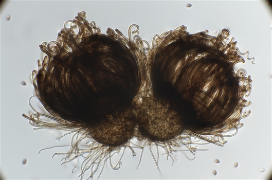 拟柔菊毛壳Chrysanthotrichum allolentum 受访者供图