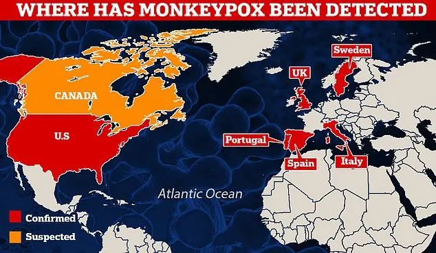 截至5月19日欧美的猴痘疫情分布图
