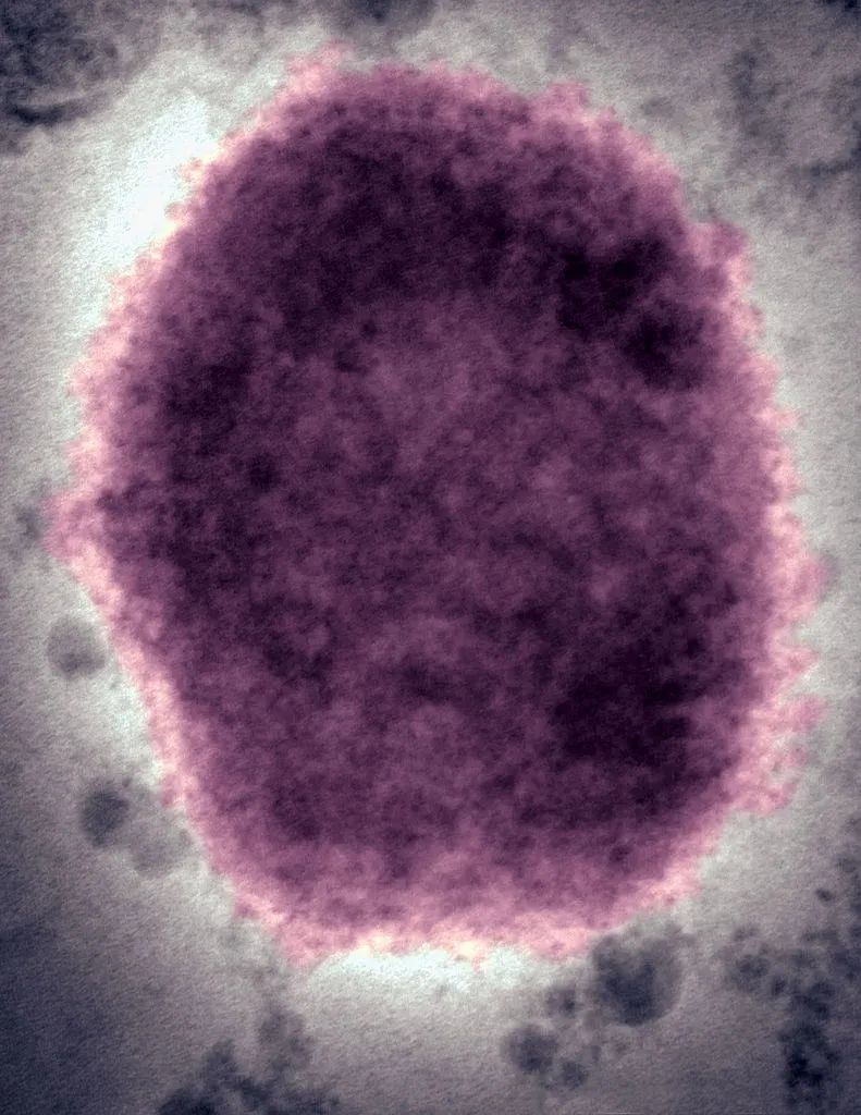 电子显微镜下的猴痘病毒