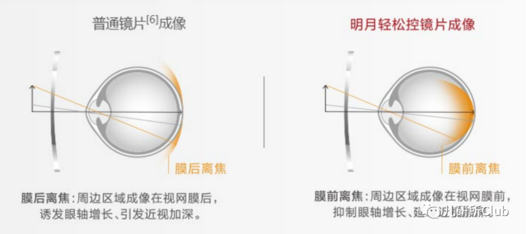 镜片中心点多少,镜片中心多少mm的成像效果好