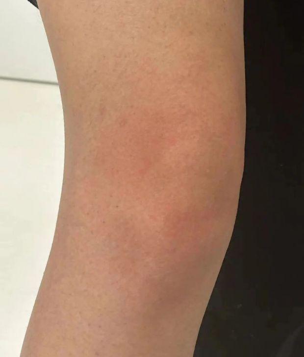 身上瘙痒是什么病 4033-ad41edcfa8333692c4809ee06495c637.jpg