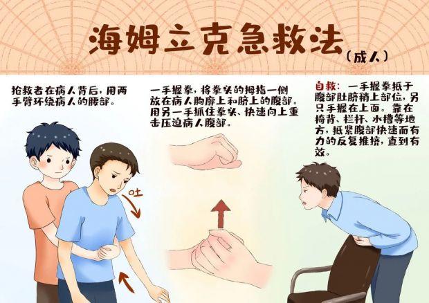 急救法海姆立克示意图 56a5-aba5bd0d20854559cc2e977601e35f6e.jpg