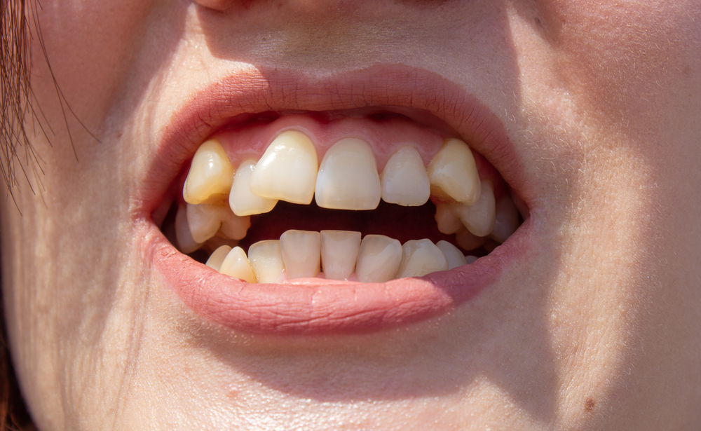 图片来源：站酷海洛