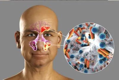 有什么方法可以快速缓解鼻腔干燥 9861-8e81e15d32568c309610d71ab43d28c7.jpg