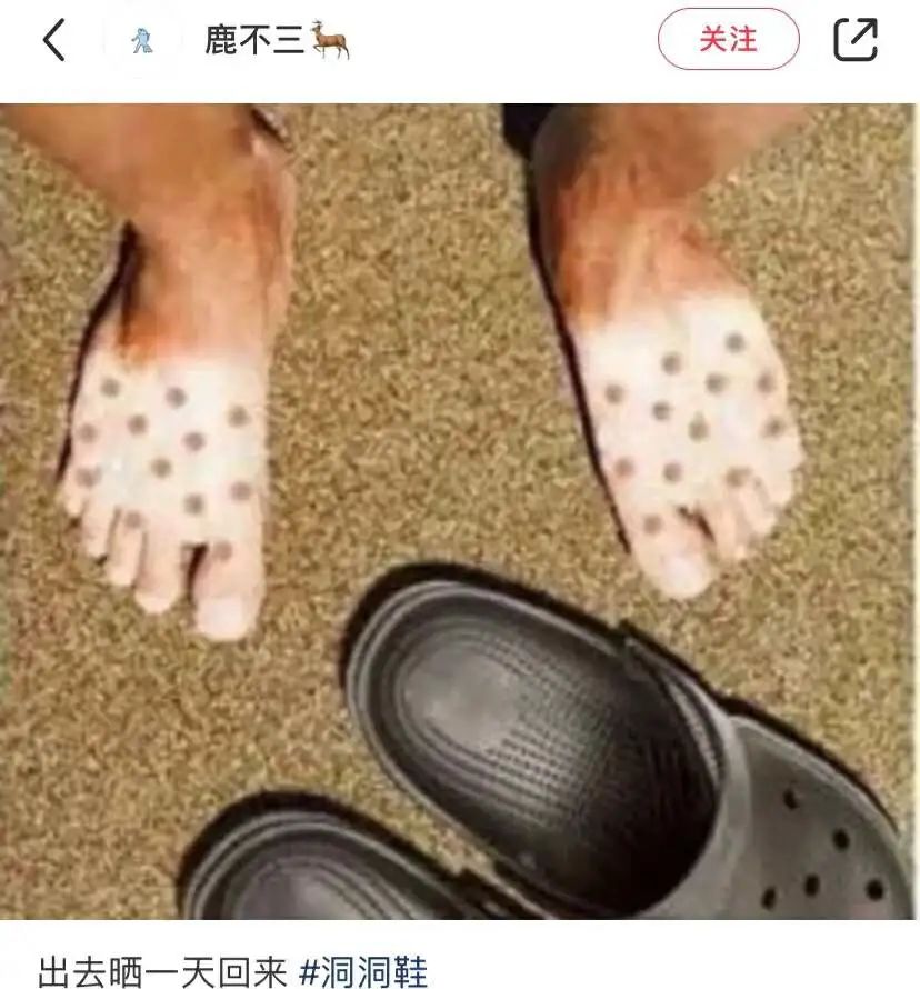 正版网红洞洞鞋 b888-88cab3b81361ef656824b88691d88436.jpg