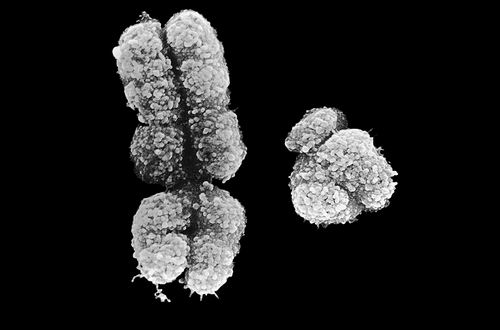 有哪几种染发，常见三种染色体