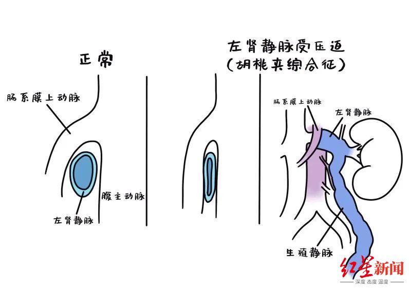 20岁男孩得了怪病，17岁少年患怪病