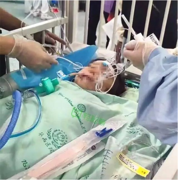 女童在医院接受救治,目前仍处于昏迷状态。视频截屏