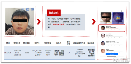 “AI+医疗”深度布局，贝康医疗(02170.HK)引领智慧医疗浪潮-第3张图片-平阳卒宛