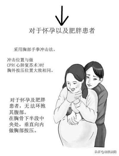 怎样自己给自己做心肺复苏 aad5-b8305ca0ab8b4a022e9b55d49df552b2.jpg