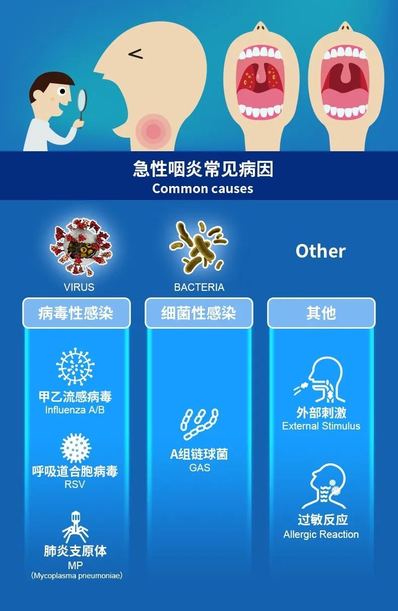 急性化脓性咽/扁桃体炎的元凶(图3)