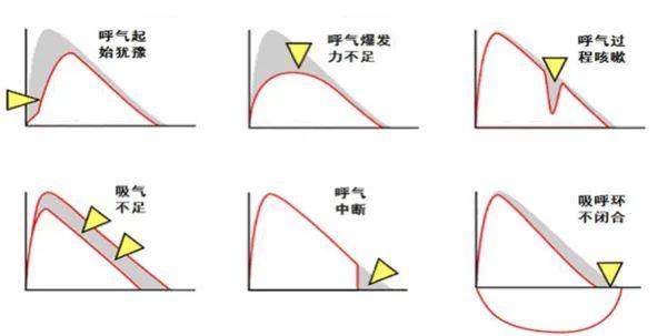 怎么在家测量肺活量 489a-df00462b0bb4edf104bbad5f49716081.jpg