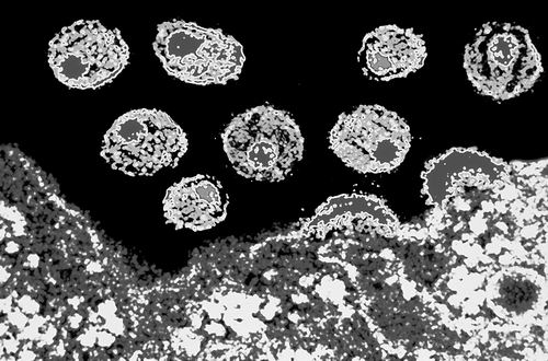 “去势”HIV通过首次测试