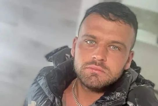 27岁英国小伙染了个发:怎么头大得跟个外星人一样