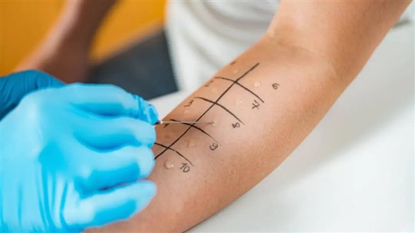 27岁英国小伙染了个发:怎么头大得跟个外星人一样