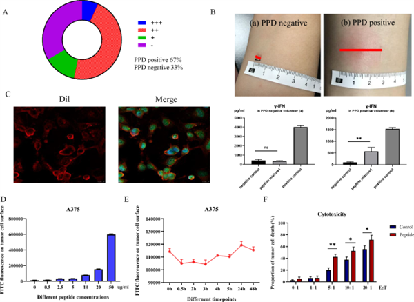 27岁英国小伙染了个发:怎么头大得跟个外星人一样