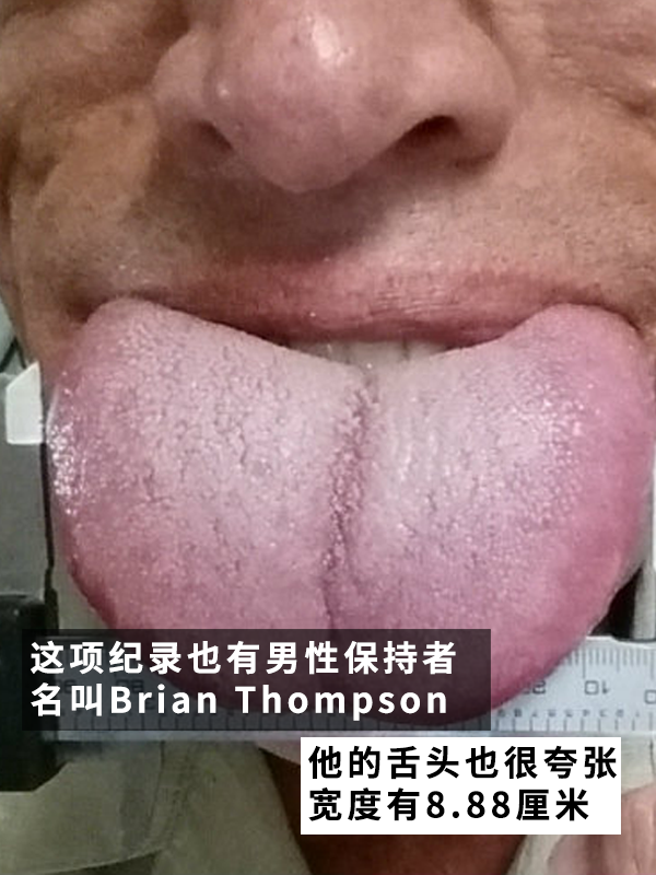 美国一姐姐拥有世界最宽的舌头!一次性可吃四个棒棒糖