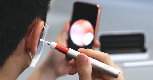 科技小物大作为:可视耳勺市场的深度解析与bebird蜂鸟品牌亮点