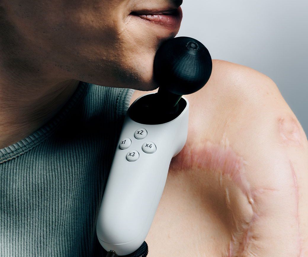 微软推出单手可用的 Xbox 无障碍操纵杆：29.99 美元，2025 年初上市