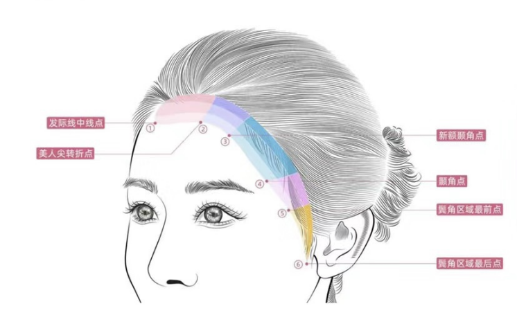 加码女性业务,雍禾医疗瞄准植发“她经济”