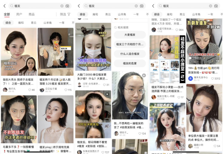 加码女性业务,雍禾医疗瞄准植发“她经济”