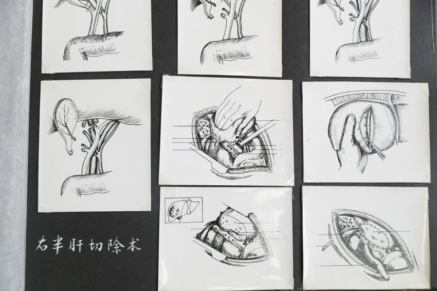 吴孟超院士生前办公室首次公开，他数十年手写标注典型患者情况