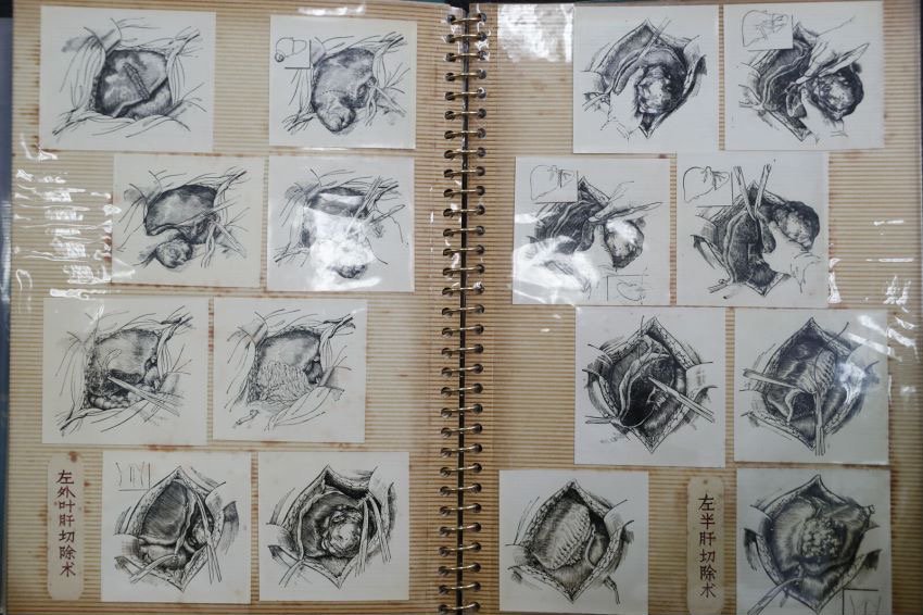 吴孟超院士生前办公室首次公开，他数十年手写标注典型患者情况