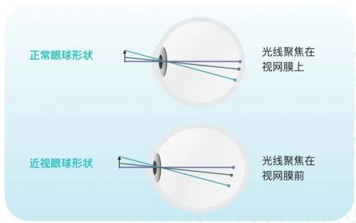 镜片儿童怎么选择,镜片儿童怎么选择尺寸