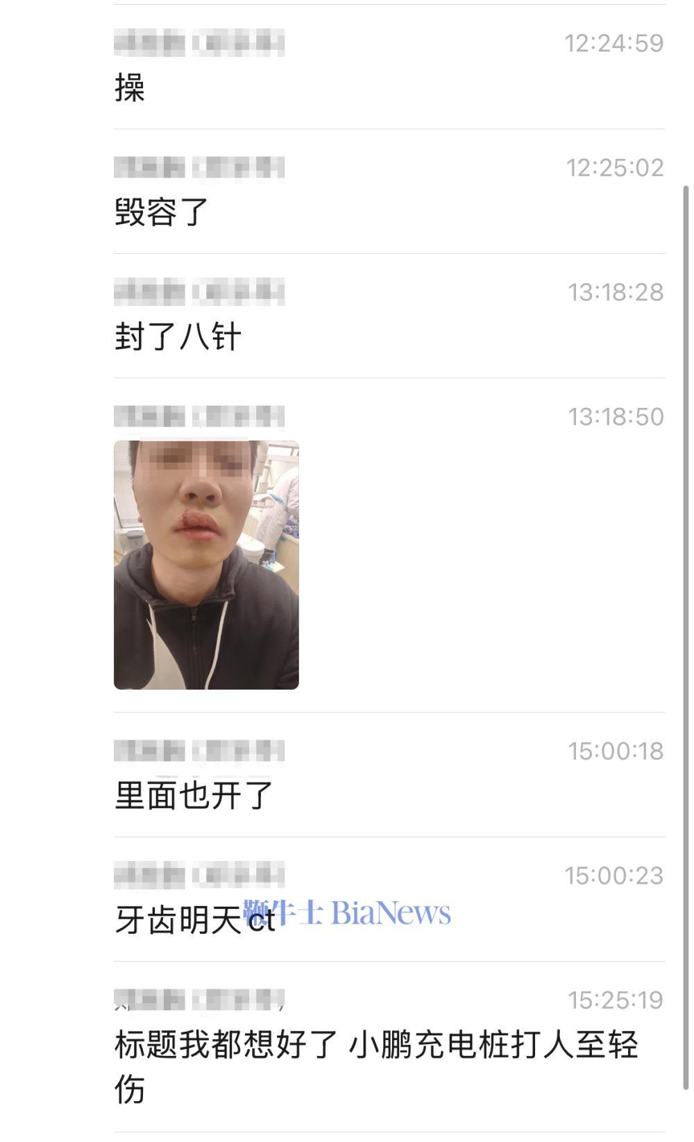聊天信息截圖顯示,小鵬汽車工作人員回應稱,會對車主反饋進行處理,并對車主身體狀況表示關心。